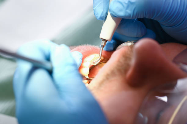 Best Broken Tooth Emergency  in Caledonia, WI