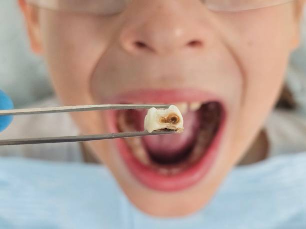Best Dentist for Dental Trauma  in Caledonia, WI